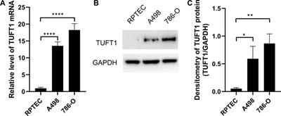 Tuftelin 1 (TUFT1) Promotes the Proliferation and Migration of Renal Cell Carcinoma via PI3K/AKT Signaling Pathway